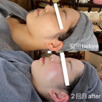 ビフォーアフター