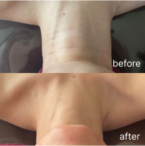 ビフォーアフター