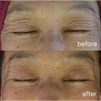 ビフォーアフター